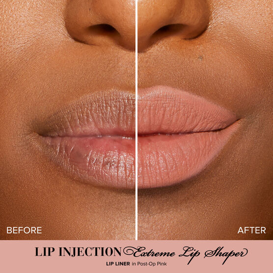 Lip Injection L�pis de Boca Post Op Pink